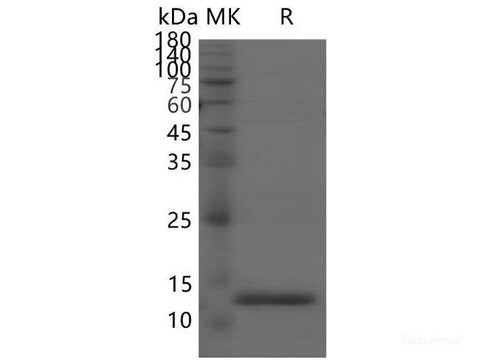 Recombinant SARS-CoV-2 Spike RBD(L452R)(His Tag)