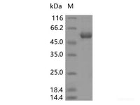 Recombinant SARS-CoV-2 N Protein (T205I)(His Tag)