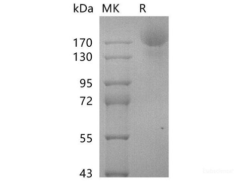 Recombinant SARS-CoV-2 S-stable trimer Protein (C-6His)(Active)