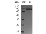 Recombinant Human IL-12 Receptor Subunit Beta1/IL-12RB1/CD212 (C-6His)