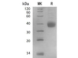 Recombinant Human NACHRA5/CHRNA5 Protein (His Tag)