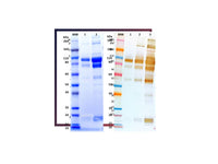 IBT Bioservices Recombinant Zaire Ebola Virus GPΔTM (Makona Strain)