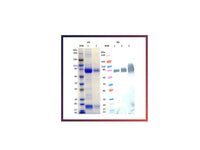 IBT Bioservices Recombinant Zaire Ebola Virus GPΔTM (S2) – 100Ug