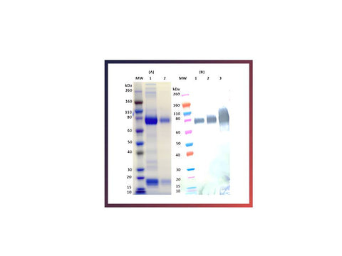 IBT Bioservices Recombinant Zaire Ebola Virus GPΔTM (S2) – 100Ug