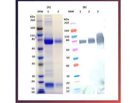 IBT Bioservices Recombinant Zaire Ebola Virus GPΔTM (S2) – 500Ug