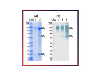 IBT Bioservices Recombinant Sudan Ebola Virus GPΔTM (Mammalian) 