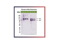 IBT Bioservices Recombinant Bundibugyo Ebola Virus GPΔTM