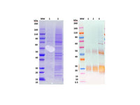 IBT Bioservices Recombinant Angola Marburg Virus GPΔTM – 100Ug