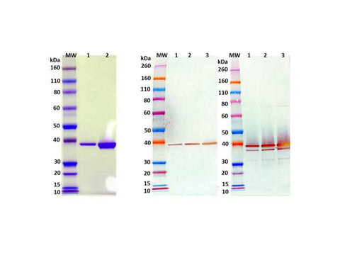 IBT Bioservices Recombinant Staphylococcus Aureus Luka-Lukb (Tag Free)