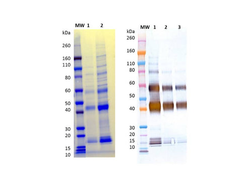 IBT Bioservices Recombinant Sudan Ebola Virus (GPΔmuc) (SF9)