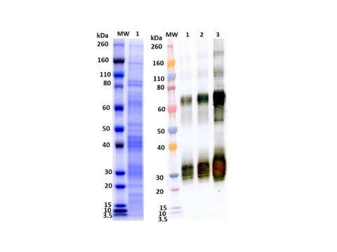 IBT Bioservices Recombinant Angola Marburg Virus GPΔmuc (SF9)