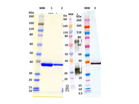 IBT Bioservices Recombinant S. Aureus Luks-Pv (His-Tagged, N-Terminus)