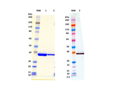 IBT Bioservices S. Aureus LUKF-PV (His-Tag, C-Terminus)