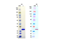 IBT Bioservices S. Aureus Recombinant LUKS-PV (Tag Free) 