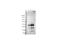 IBT Bioservices Zika Virus NS2B-NS3 (S2) Protein 