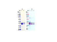 IBT Bioservices Recombinant Sudan Virus VP40 (SUDV Vp40)