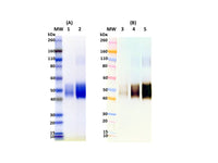 IBT Bioservices Recombinant Sudan Virus Soluble GP (SGP) 