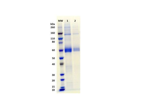 IBT Bioservices Recombinant Influenza Hemagglutinin Glycoprotein (H7 Anhui)