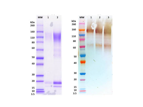 IBT Bioservices Recombinant Sudan Ebola Virus GPΔTM (Mammalian)