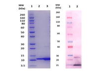 IBT Bioservices ESXB Protein (S. Aureus) 