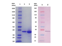 IBT Bioservices Fhud2 Protein (S. Aureus)