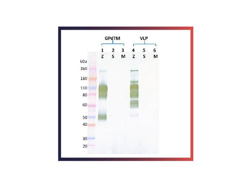 IBT Bioservices Rabbit Anti-Ebola Virus GP PAB