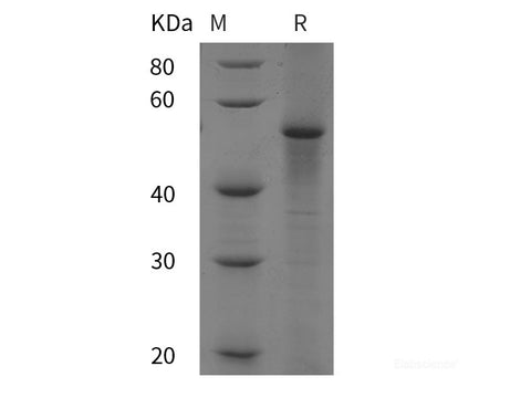 Recombinant Bovine P53/TP53 protein (His tag)
