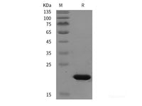 Recombinant Bovine TGFBR1 protein (His tag)