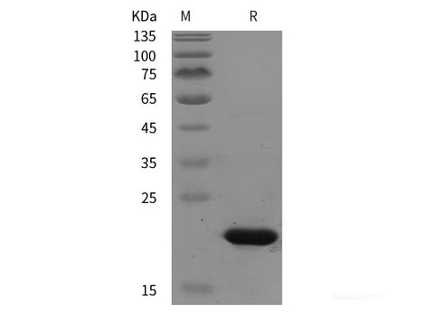 Recombinant Bovine TGFBR1 protein (His tag)