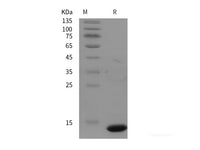 Recombinant Rhinopithecus roxellana IGF1/IGF‑I/IGF-1 protein (His tag)