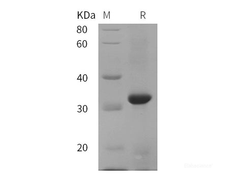 Recombinant Cynomolgus macaques CD38/ADPRC1 protein (His tag)