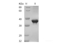 Recombinant Cynomolgus macaques ABL1 protein (His tag)