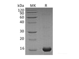 Recombinant Human AIF1 Protein (His Tag)