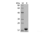 Recombinant Human Parvalbumin Alpha/PVALB Protein (His Tag)
