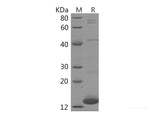 Recombinant Human FABP3 Protein (His Tag)