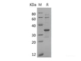 Recombinant Human CDK2 Protein (E.coli, His Tag)