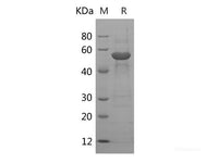 Recombinant Human PBEF/NAMPT Protein (His Tag)