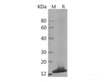 Recombinant Human FABP2/I-FABP Protein (His Tag)