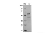 Recombinant Human THP protein(His tag)