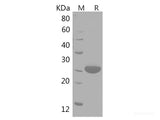 Recombinant Human ACTN1 protein(His tag)