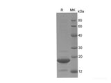 Recombinant Human MAP1LC3B protein(His tag)