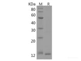 Recombinant Human MCP3/CCL7 protein(His tag)