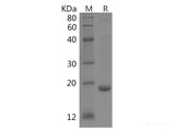 Recombinant Human Fyn protein(His tag)