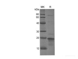 Recombinant Human PPARG protein(His tag)