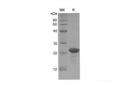 Recombinant Human FGF14 Isoform 1B protein(His tag)