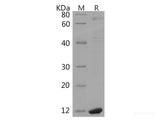 Recombinant Human THAP1 protein(His tag)