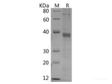 Recombinant Human AGER protein(His tag)