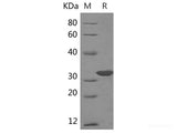 Recombinant Human MeCP2 protein(His tag)