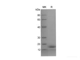 Recombinant Human TNNC1 protein (His tag)