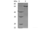 Recombinant Human AMH protein (His tag)